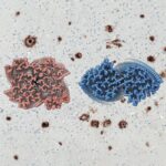 Atomic structure for Type I (Left) and Type II (Right) of amyloid-β 42 filaments
