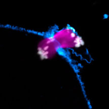 Chromosome Segregation Error Human Oocyte Schuh 6-15