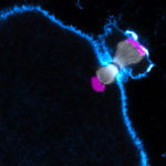 Chromosome Segregation Human Oocyte