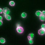 Live fluorescence microscopy of two fluorescently labeled proteins involved in the formation of contact sites