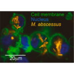 M. abscessus infection of human macrophage cell line (THP1) imaged through high content microscopy