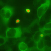 Ubiquilins (green) and Huntington’s disease aggregates (red) in a cell