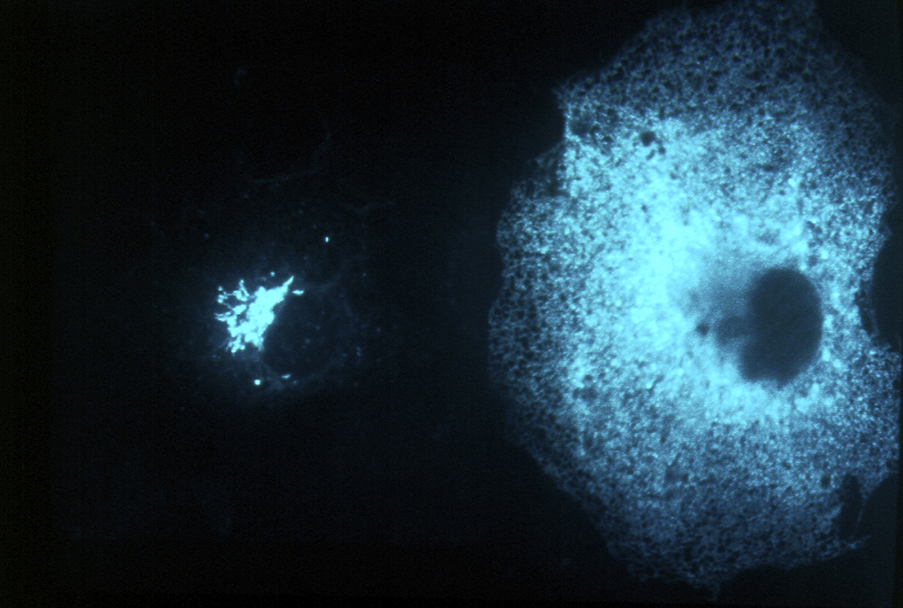 KDEL cells2