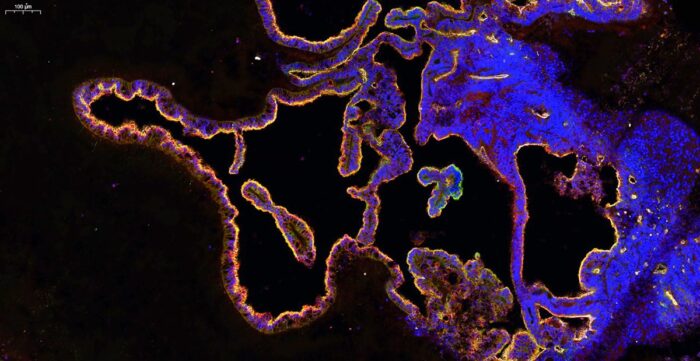 Microscopy image of the highly convoluted choroid plexus epithelium in organoids expressing tight junction markers and membrane transporters that regulate entry of molecules into the brain