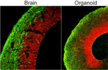 brain and organoid