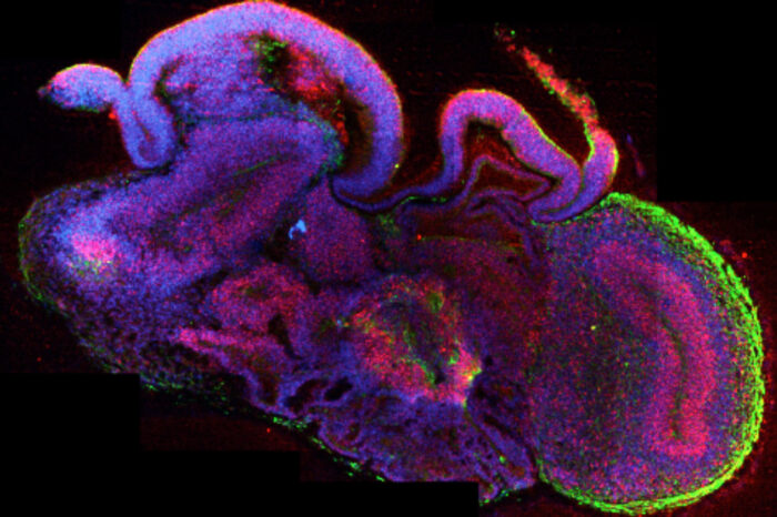Organoid