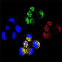 Protein Folding Defects