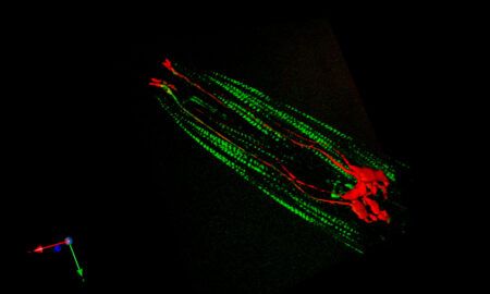 micrograph