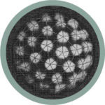 Electron micrograph image