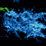 granuloma TNFhigh